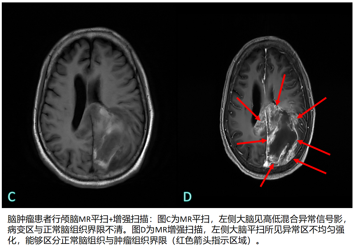 db76a7ade7c40434d369b12d81df1471.png